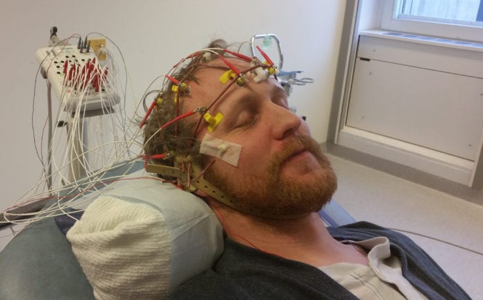 Paediatric Brain Haemorrhage