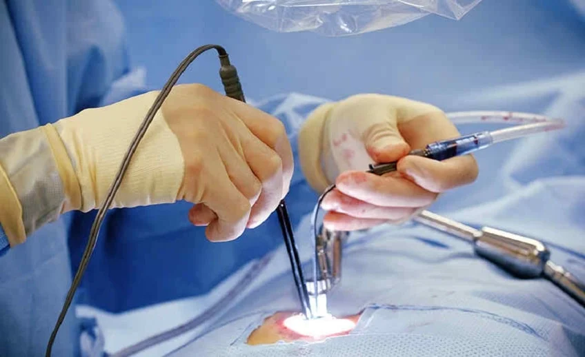 Neuro Spine Specialist in Delhi