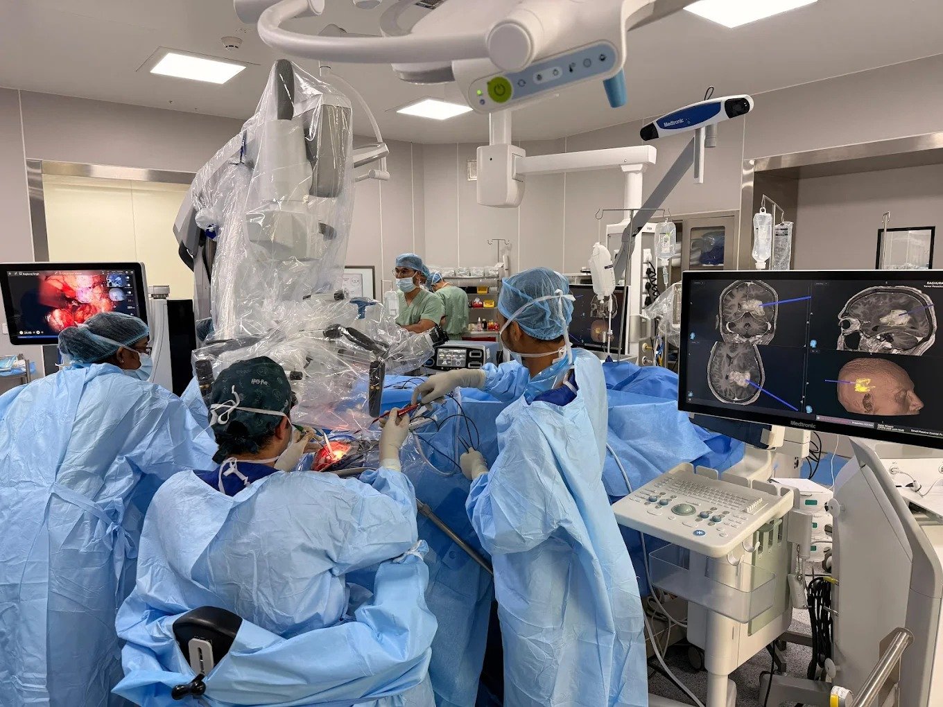 Neurosurgical team during surgery