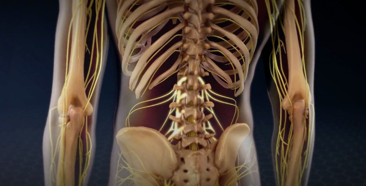 Lumbar laminectomy surgery for spinal nerve compression